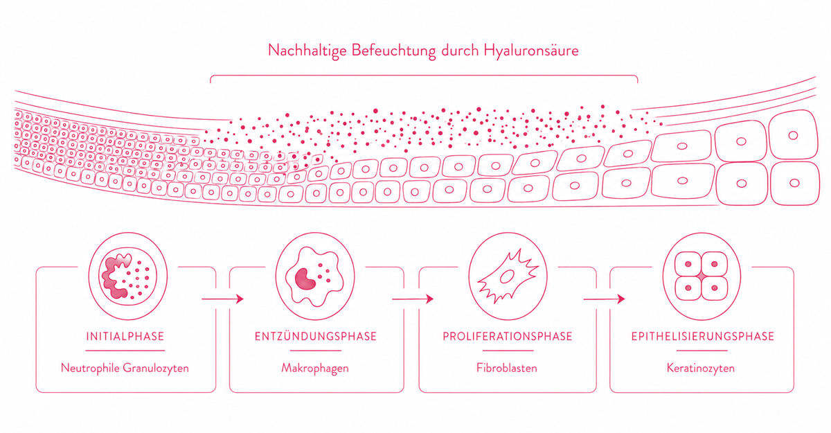 Hyaluxelle Behandlung